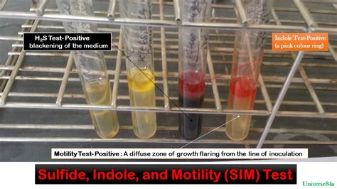 sim indole test.